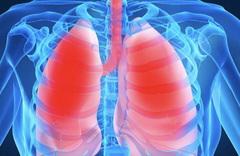 Medicamento para tratar asma alérgica grave será ofertado no SUS